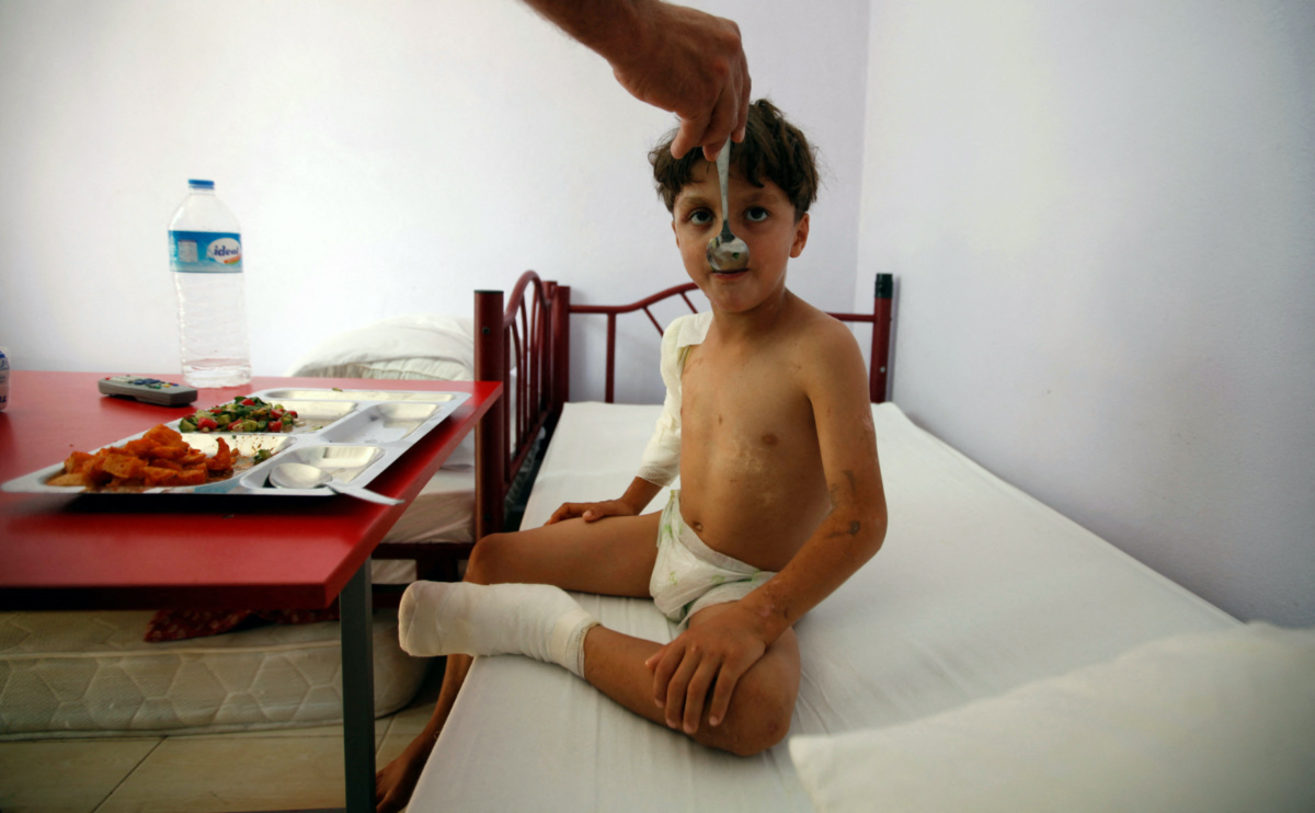 Syria injured refugee boy