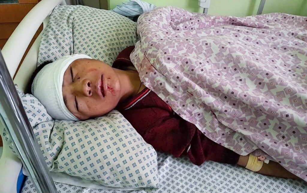 Afghanistan Aybak bomb blast victim