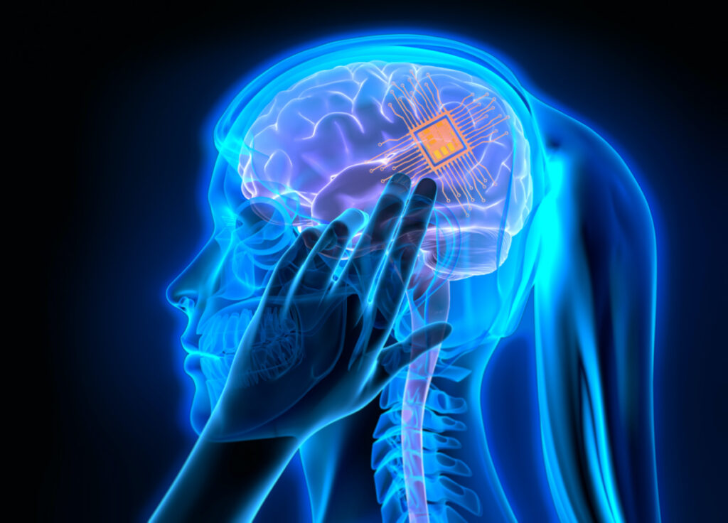 Neural implants illustration