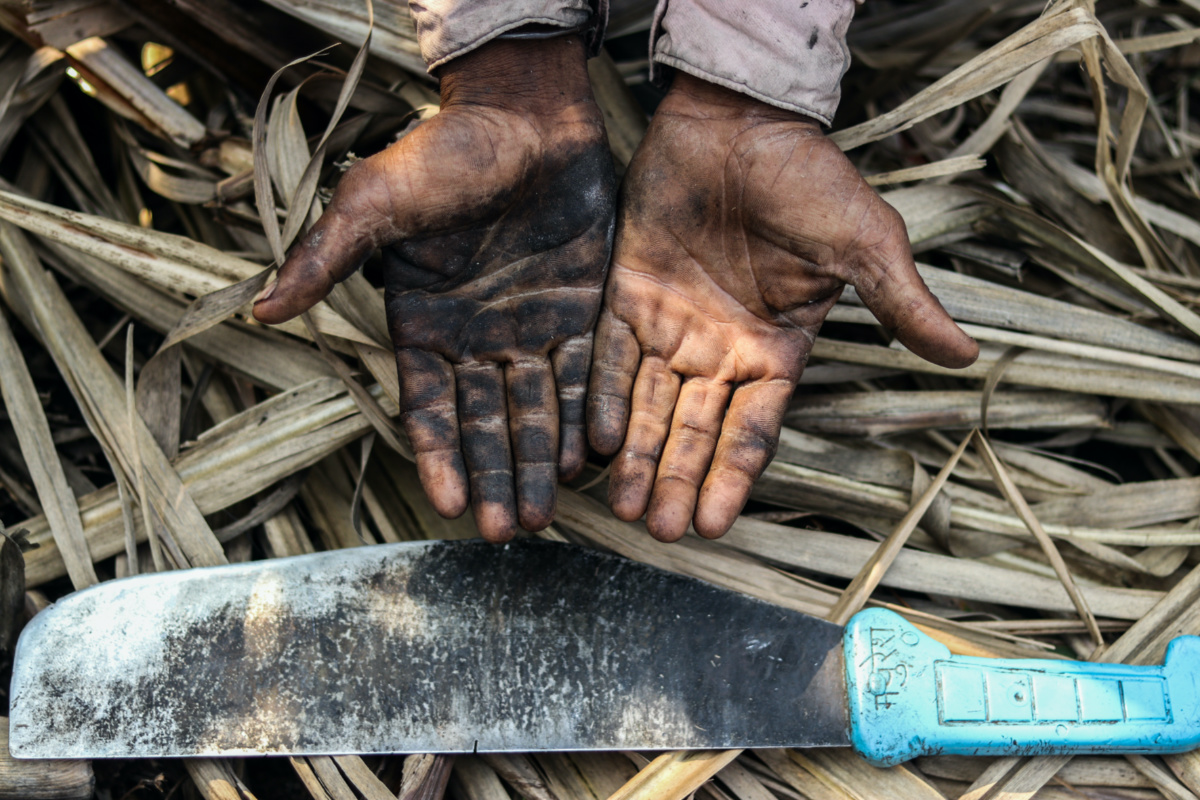 A sugarcane cutter showing his hands after working in the fields for several hours without any protective gear in a sugarcane field in in Maharashtra’s Khochi village, India. December 17, 2022. Sanket Jain/Thomson Reuters Foundati